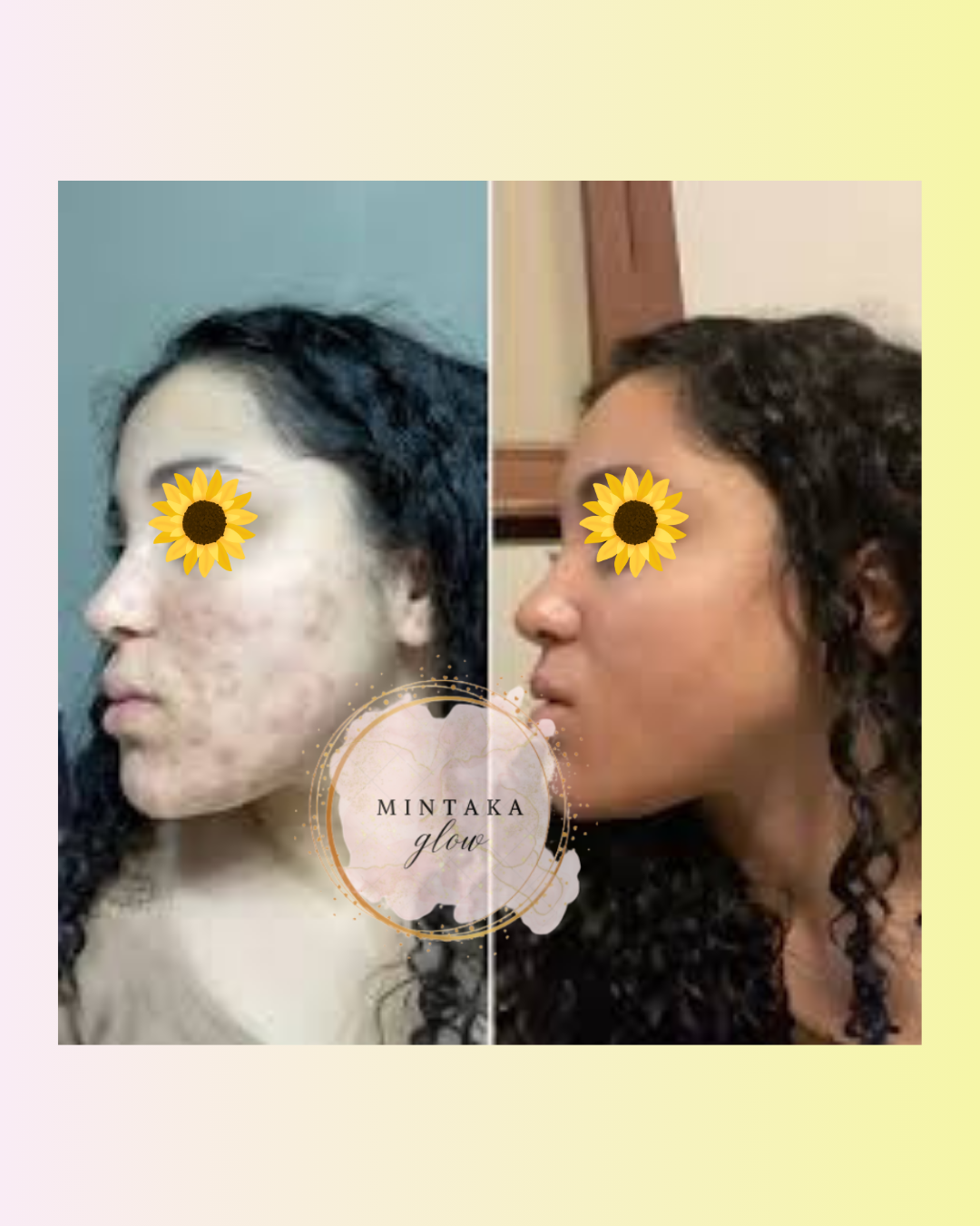 Brightening Lemon Turmeric Kojic Acid Soap